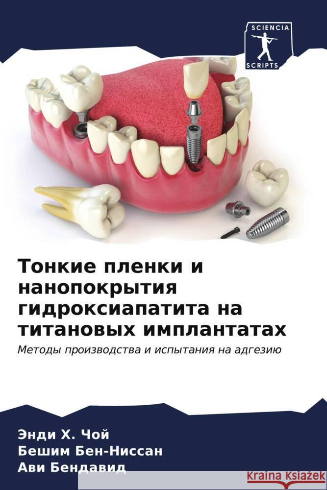 Tonkie plenki i nanopokrytiq gidroxiapatita na titanowyh implantatah Choj, Jendi H., Ben-Nissan, Beshim, Bendawid, Awi 9786207100217