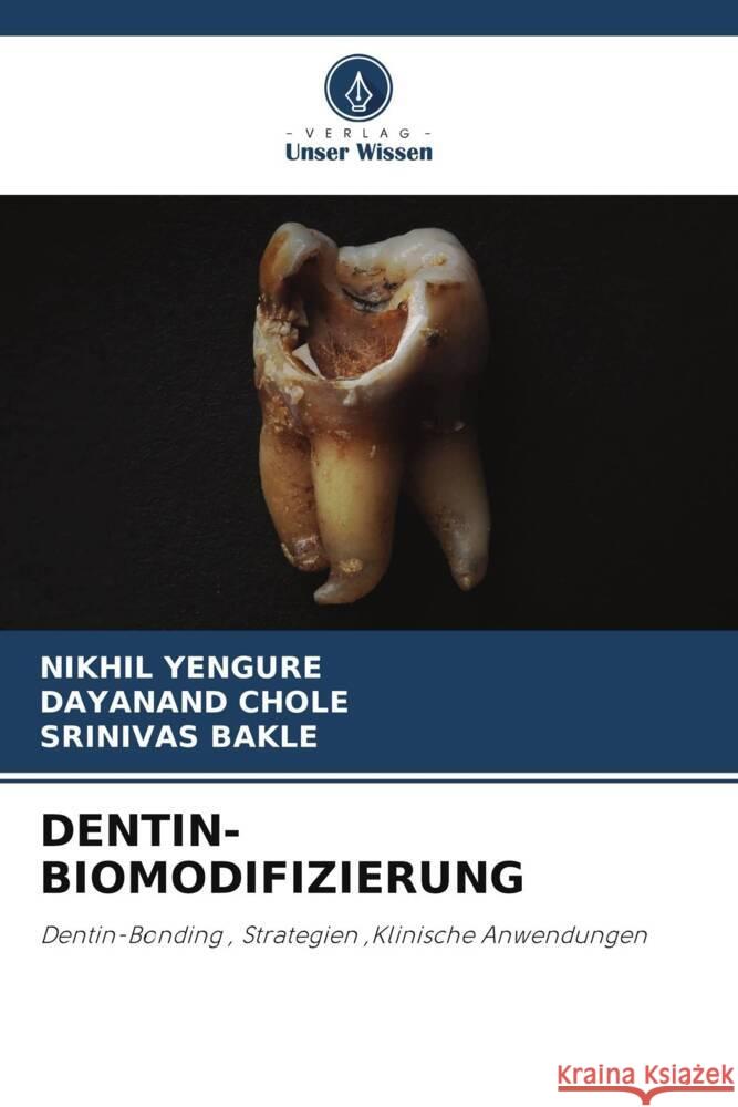 Dentin-Biomodifizierung Nikhil Yengure Dayanand Chole Srinivas Bakle 9786207103706 Verlag Unser Wissen