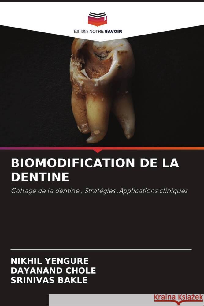 Biomodification de la Dentine Nikhil Yengure Dayanand Chole Srinivas Bakle 9786207103713 Editions Notre Savoir