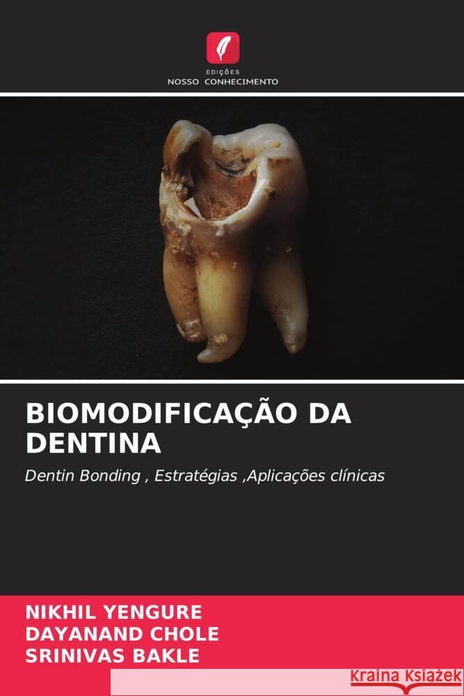 Biomodifica??o Da Dentina Nikhil Yengure Dayanand Chole Srinivas Bakle 9786207103744