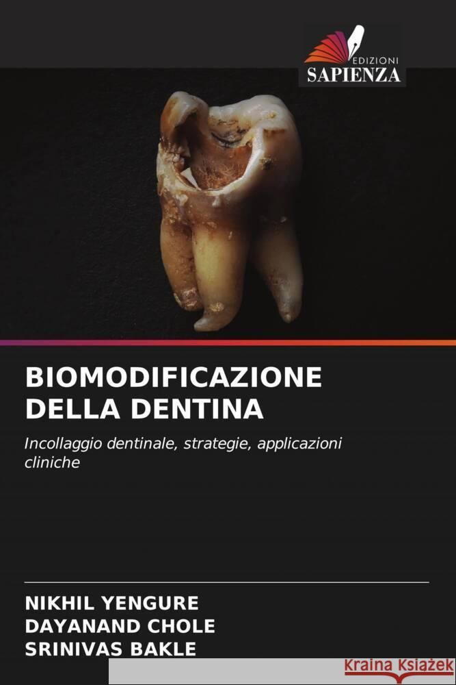 Biomodificazione Della Dentina Nikhil Yengure Dayanand Chole Srinivas Bakle 9786207103775 Edizioni Sapienza