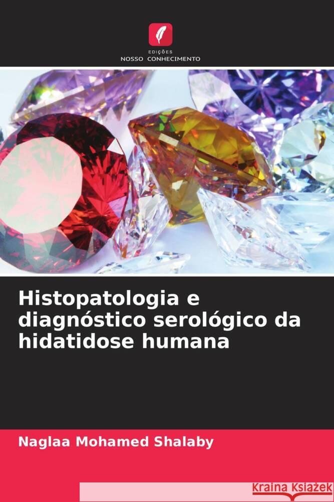 Histopatologia e diagnóstico serológico da hidatidose humana Shalaby, Naglaa Mohamed 9786207105304