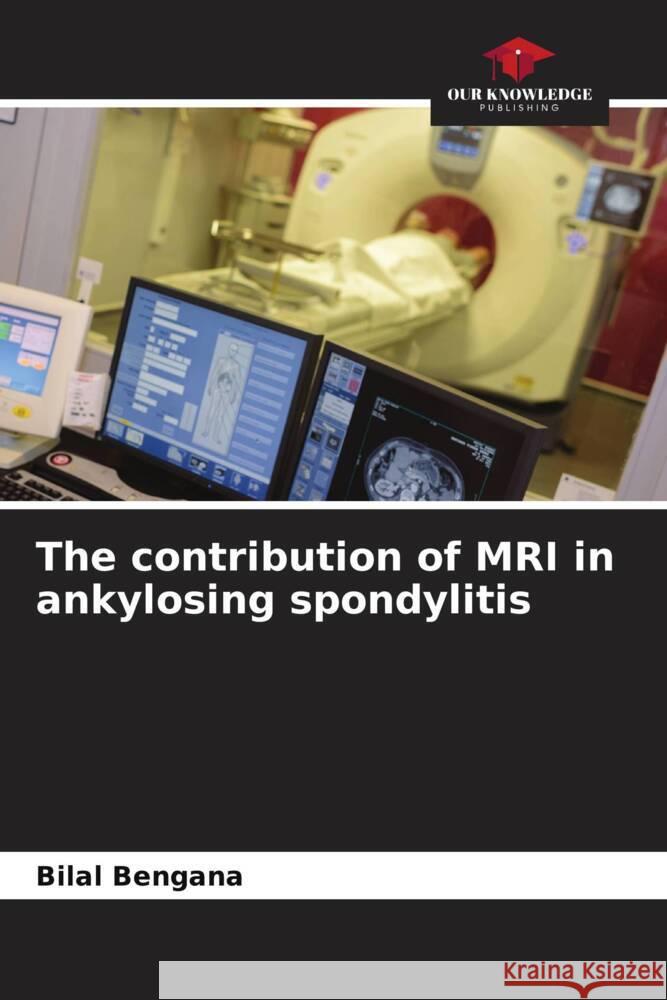 The contribution of MRI in ankylosing spondylitis Bilal Bengana 9786207115570