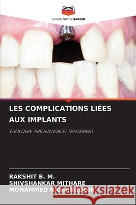 Les Complications Li?es Aux Implants Rakshit B Shivshankar Mithare Mohammed Nashiroddin 9786207122035 Editions Notre Savoir