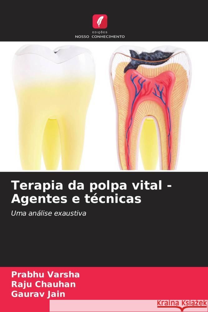 Terapia da polpa vital - Agentes e técnicas Varsha, Prabhu, Chauhan, Raju, Jain, Gaurav 9786207129911