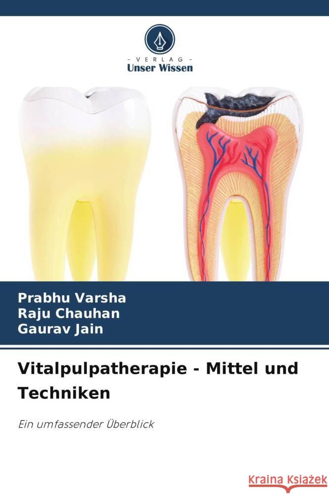 Vitalpulpatherapie - Mittel und Techniken Varsha, Prabhu, Chauhan, Raju, Jain, Gaurav 9786207129997