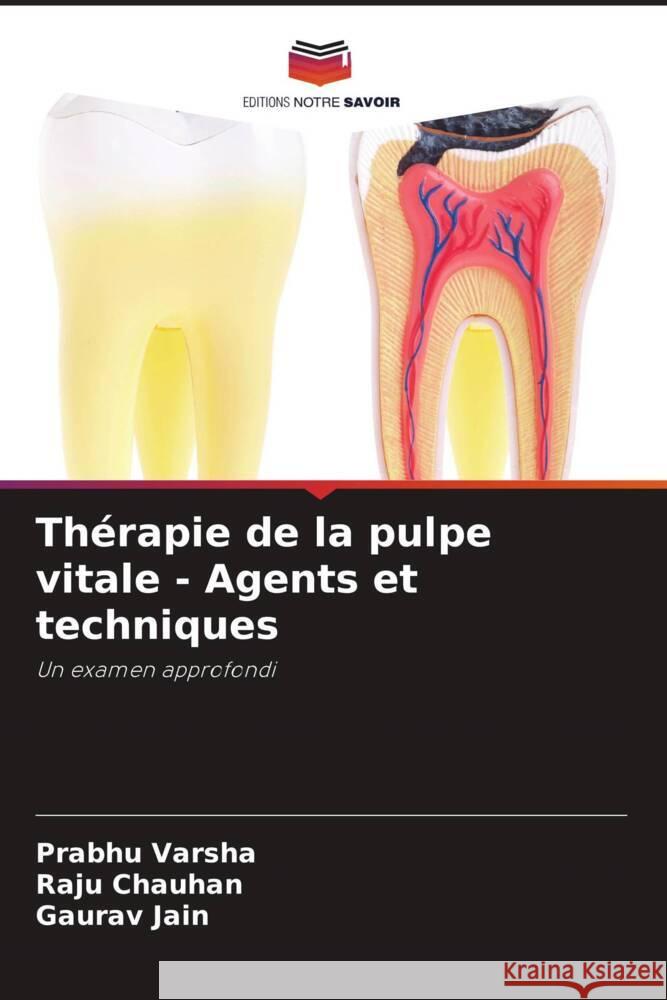 Thérapie de la pulpe vitale - Agents et techniques Varsha, Prabhu, Chauhan, Raju, Jain, Gaurav 9786207130030