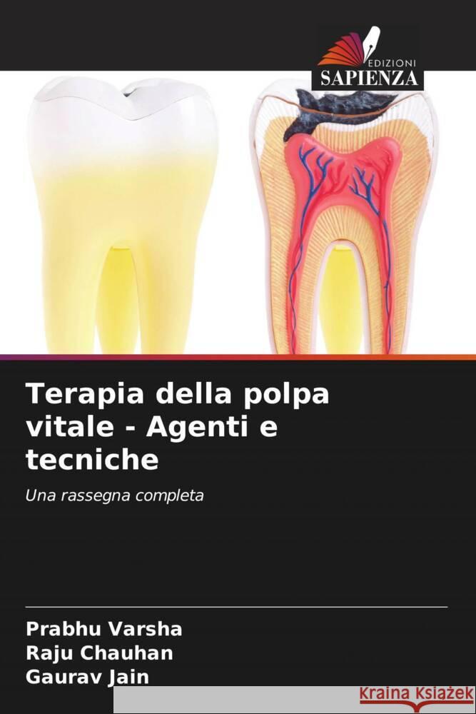 Terapia della polpa vitale - Agenti e tecniche Varsha, Prabhu, Chauhan, Raju, Jain, Gaurav 9786207130054