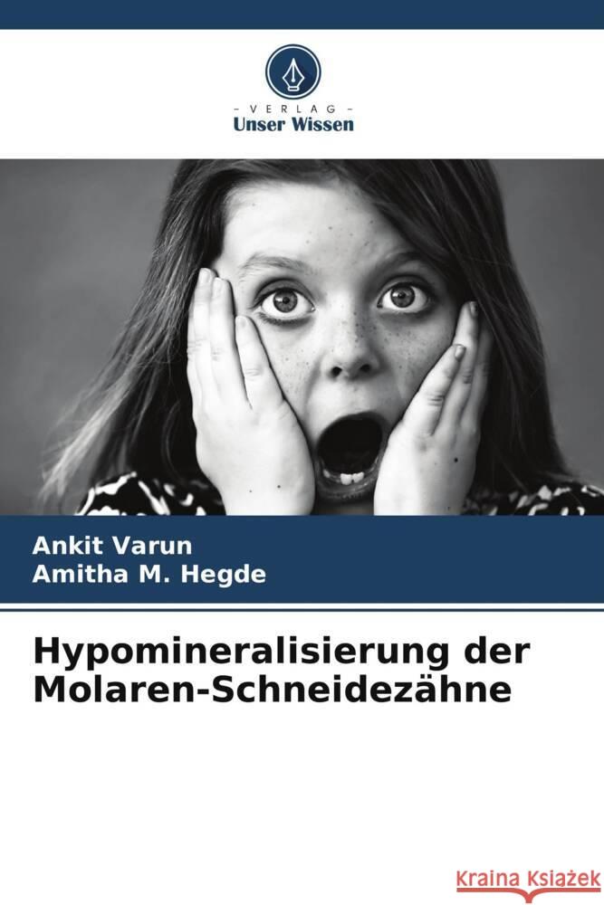 Hypomineralisierung der Molaren-Schneidezähne Varun, Ankit, Hegde, Amitha M. 9786207130511