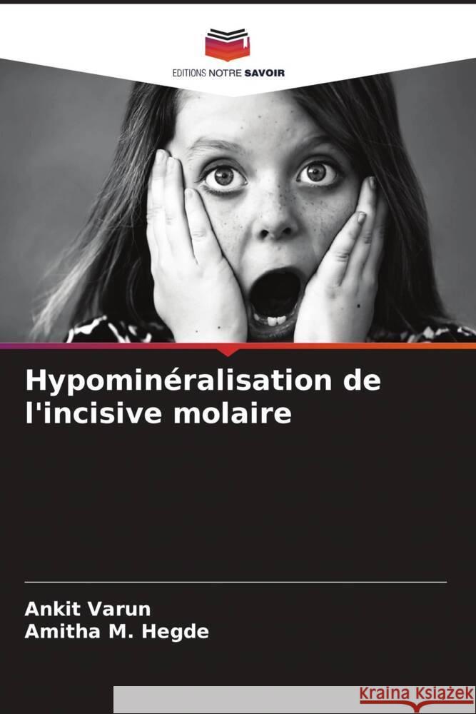 Hypominéralisation de l'incisive molaire Varun, Ankit, Hegde, Amitha M. 9786207130535