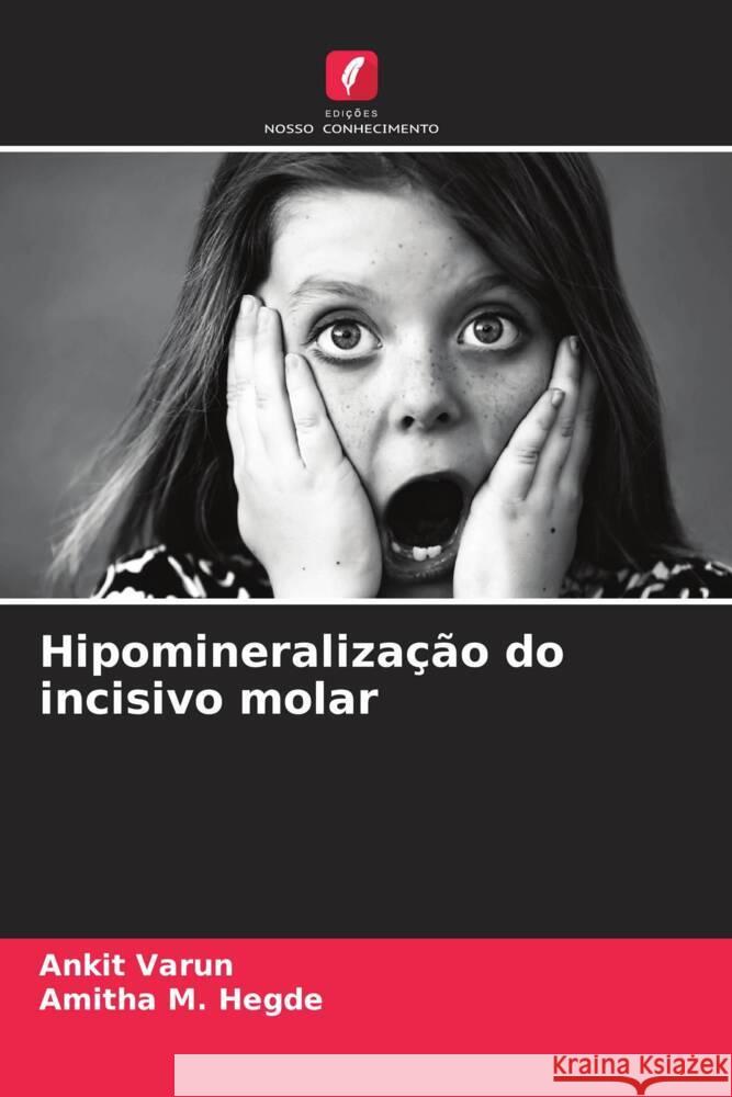 Hipomineralização do incisivo molar Varun, Ankit, Hegde, Amitha M. 9786207130566