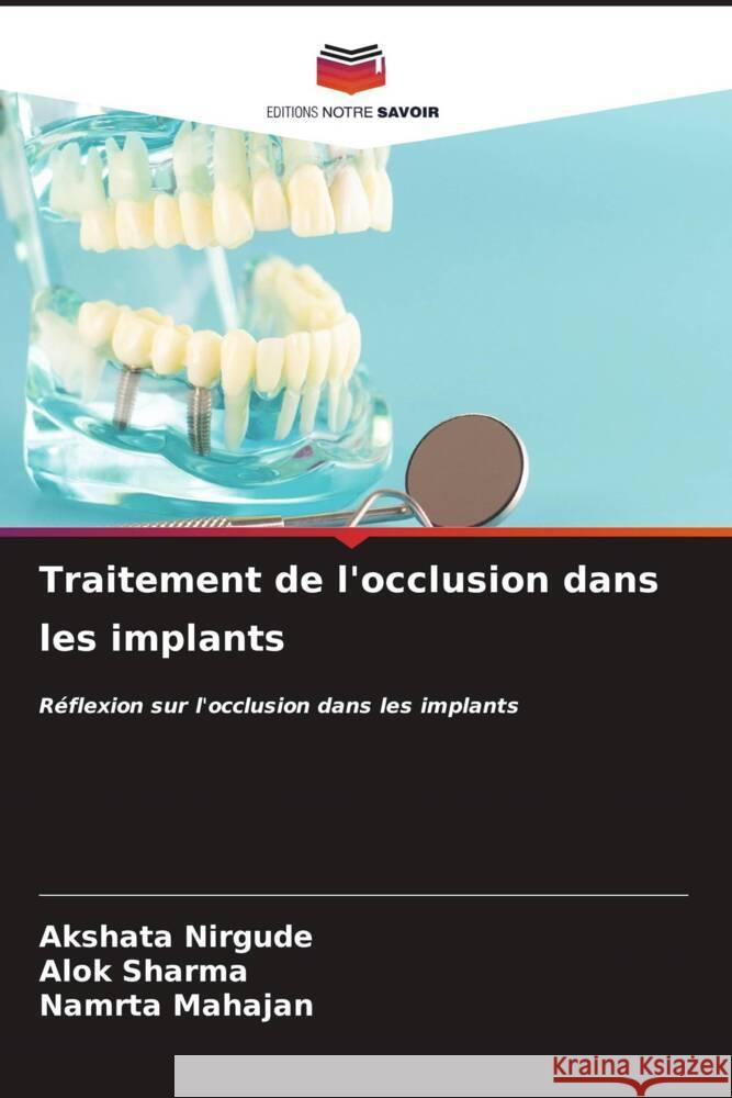 Traitement de l'occlusion dans les implants Akshata Nirgude Alok Sharma Namrta Mahajan 9786207150472