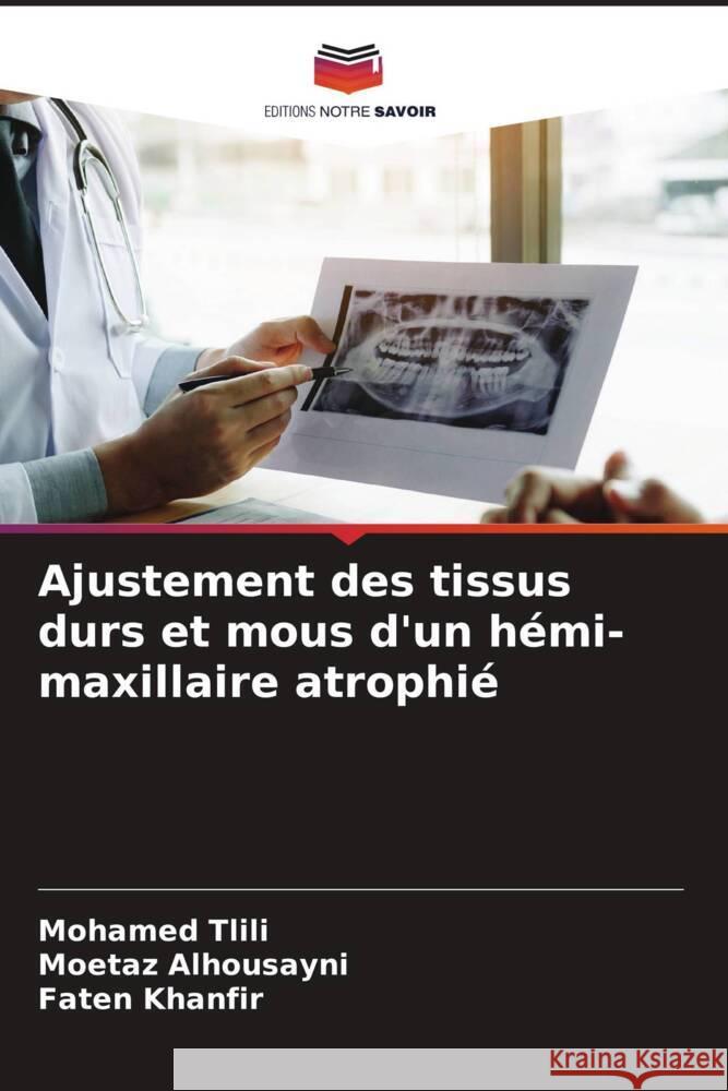 Ajustement des tissus durs et mous d'un hémi-maxillaire atrophié Tlili, Mohamed, Alhousayni, Moetaz, Khanfir, Faten 9786207158997