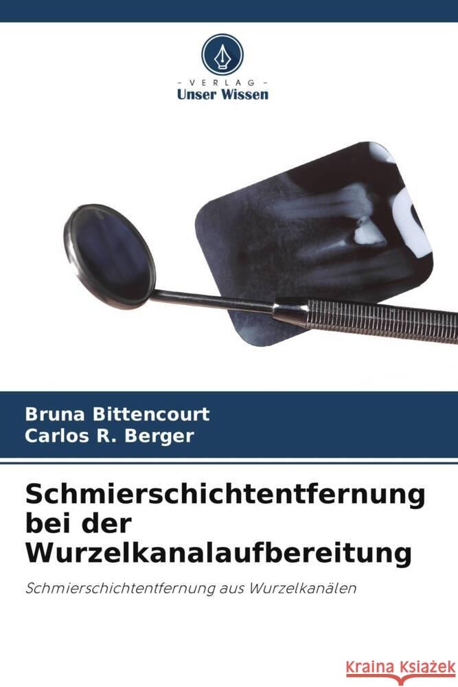 Schmierschichtentfernung bei der Wurzelkanalaufbereitung Bruna Bittencourt Carlos R. Berger 9786207159345