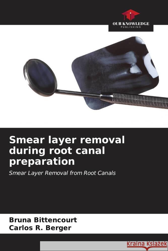 Smear layer removal during root canal preparation Bruna Bittencourt Carlos R. Berger 9786207159390