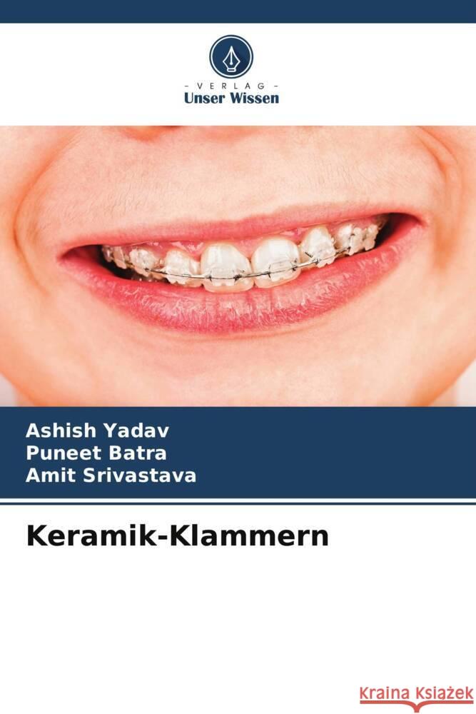 Keramik-Klammern Ashish Yadav Puneet Batra Amit Srivastava 9786207160495 Verlag Unser Wissen