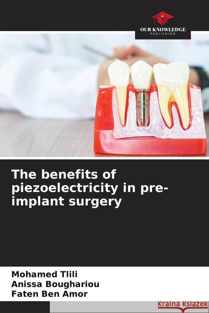 The benefits of piezoelectricity in pre-implant surgery Mohamed Tlili Anissa Boughariou Faten Be 9786207162598 Our Knowledge Publishing