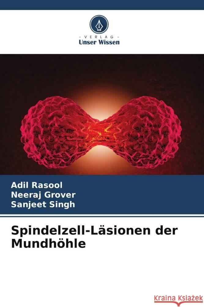 Spindelzell-L?sionen der Mundh?hle Adil Rasool Neeraj Grover Sanjeet Singh 9786207163663 Verlag Unser Wissen