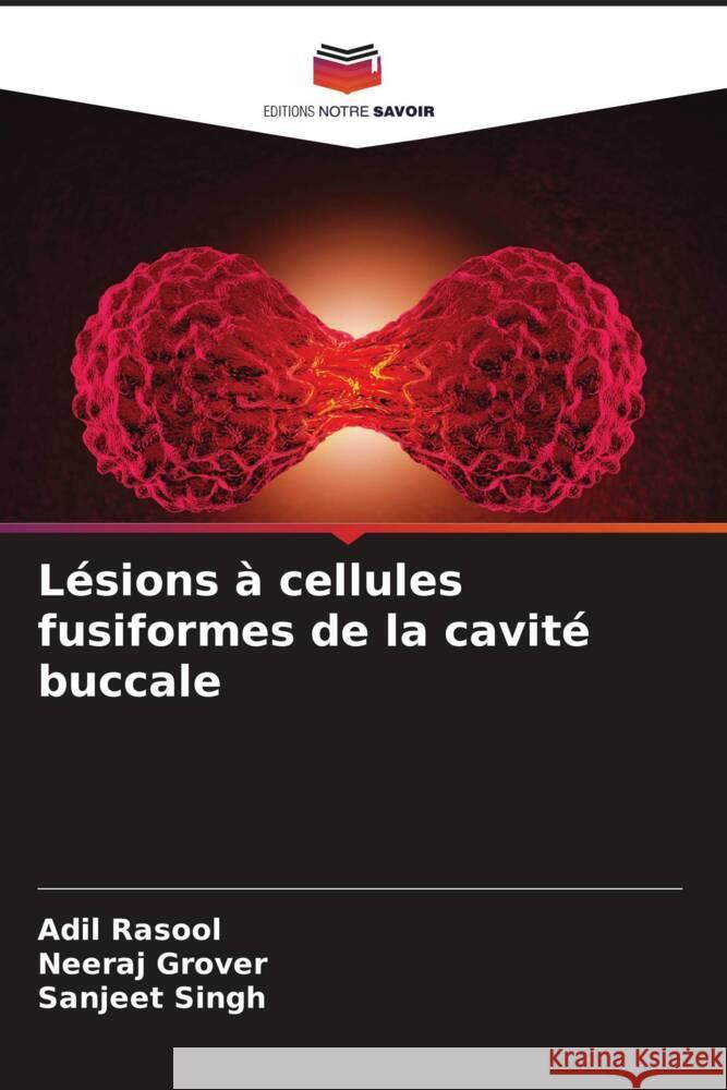 L?sions ? cellules fusiformes de la cavit? buccale Adil Rasool Neeraj Grover Sanjeet Singh 9786207163670 Editions Notre Savoir