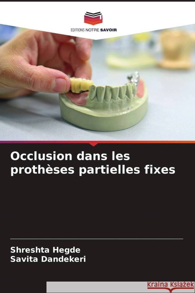 Occlusion dans les proth?ses partielles fixes Shreshta Hegde Savita Dandekeri 9786207166312