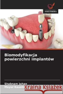 Biomodyfikacja powierzchni implantów Jahan, Shabnam, Kaushik, Mayur 9786207171583