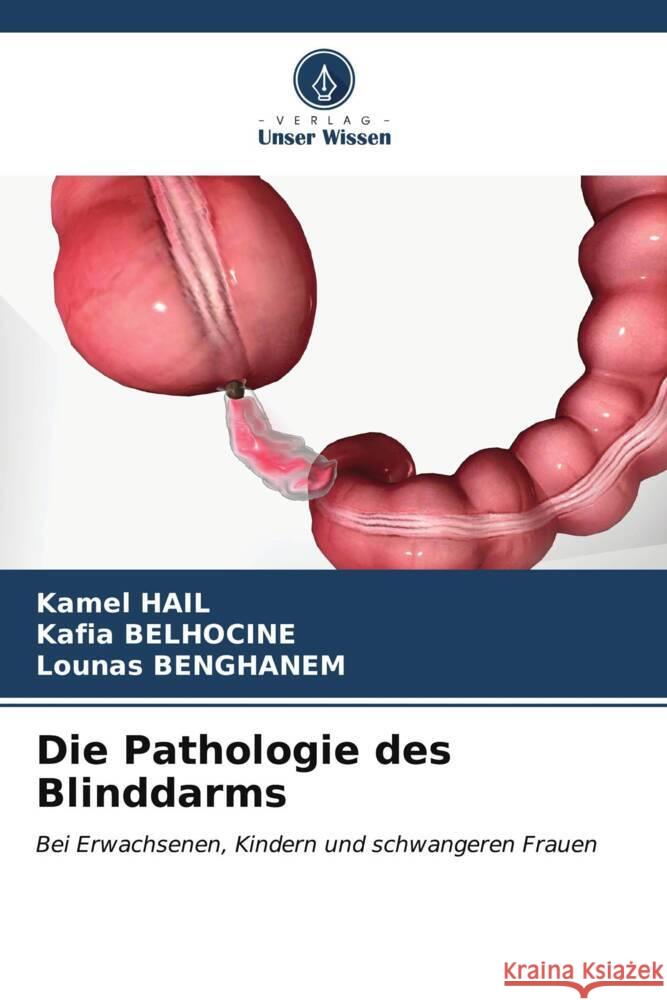 Die Pathologie des Blinddarms Kamel Hail Kafia Belhocine Lounas Benghanem 9786207181773 Verlag Unser Wissen