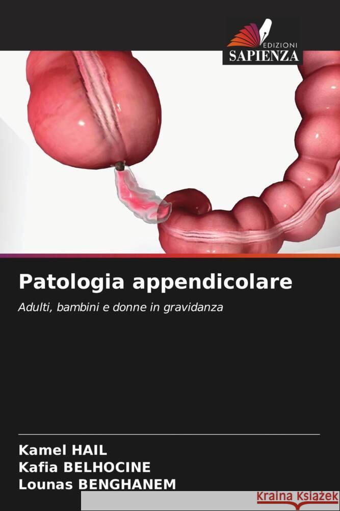 Patologia appendicolare Kamel Hail Kafia Belhocine Lounas Benghanem 9786207181803 Edizioni Sapienza