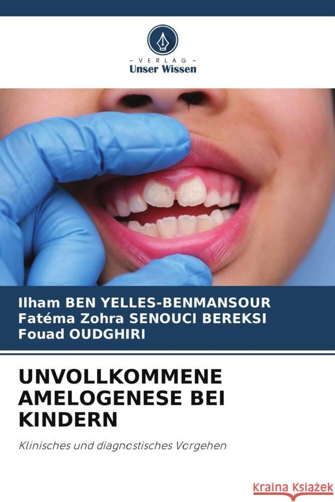 Unvollkommene Amelogenese Bei Kindern Ilham Be Fat?ma Zohra Senouc Fouad Oudghiri 9786207198788