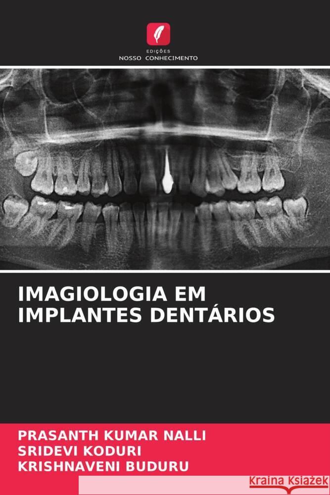 Imagiologia Em Implantes Dent?rios Prasanth Kumar Nalli Sridevi Koduri Krishnaveni Buduru 9786207204311