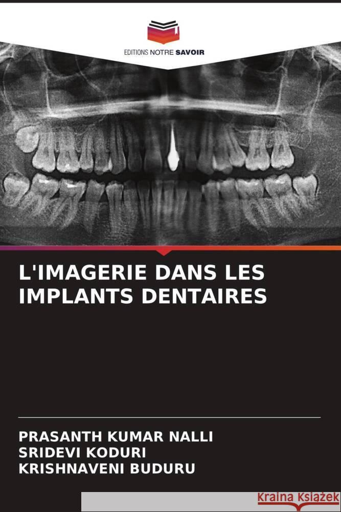 L'Imagerie Dans Les Implants Dentaires Prasanth Kumar Nalli Sridevi Koduri Krishnaveni Buduru 9786207204410