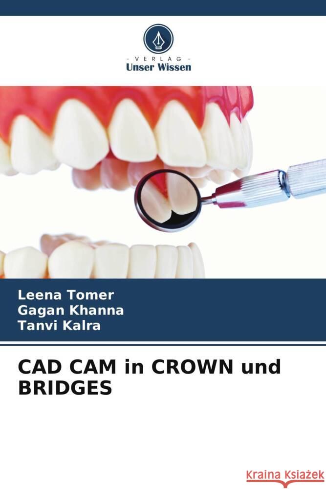 CAD CAM in CROWN und BRIDGES Leena Tomer Gagan Khanna Tanvi Kalra 9786207225002