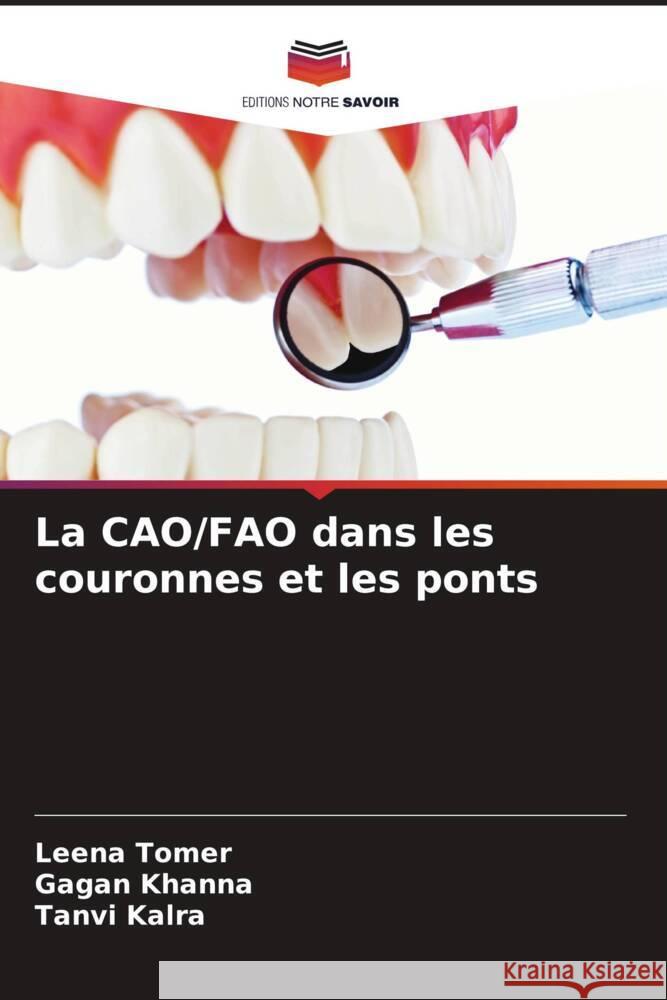 La CAO/FAO dans les couronnes et les ponts Leena Tomer Gagan Khanna Tanvi Kalra 9786207225026