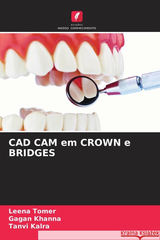 CAD CAM em CROWN e BRIDGES Leena Tomer Gagan Khanna Tanvi Kalra 9786207225040