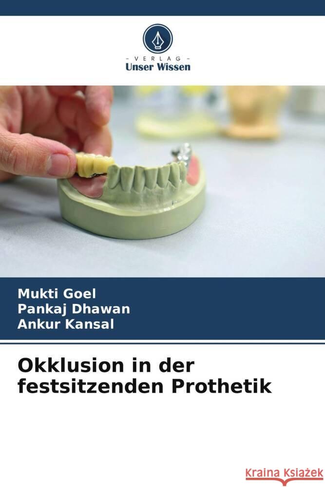 Okklusion in der festsitzenden Prothetik Mukti Goel Pankaj Dhawan Ankur Kansal 9786207229642 Verlag Unser Wissen