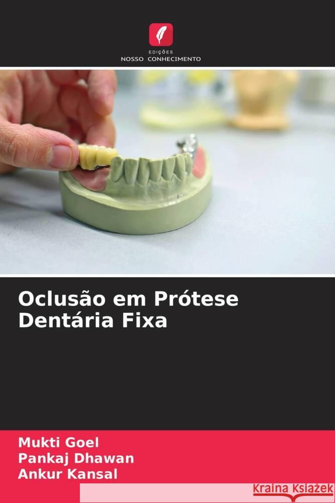 Oclus?o em Pr?tese Dent?ria Fixa Mukti Goel Pankaj Dhawan Ankur Kansal 9786207229673 Edicoes Nosso Conhecimento