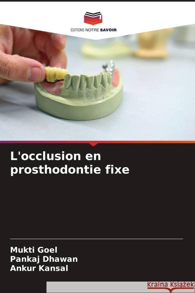 L'occlusion en prosthodontie fixe Mukti Goel Pankaj Dhawan Ankur Kansal 9786207229697 Editions Notre Savoir