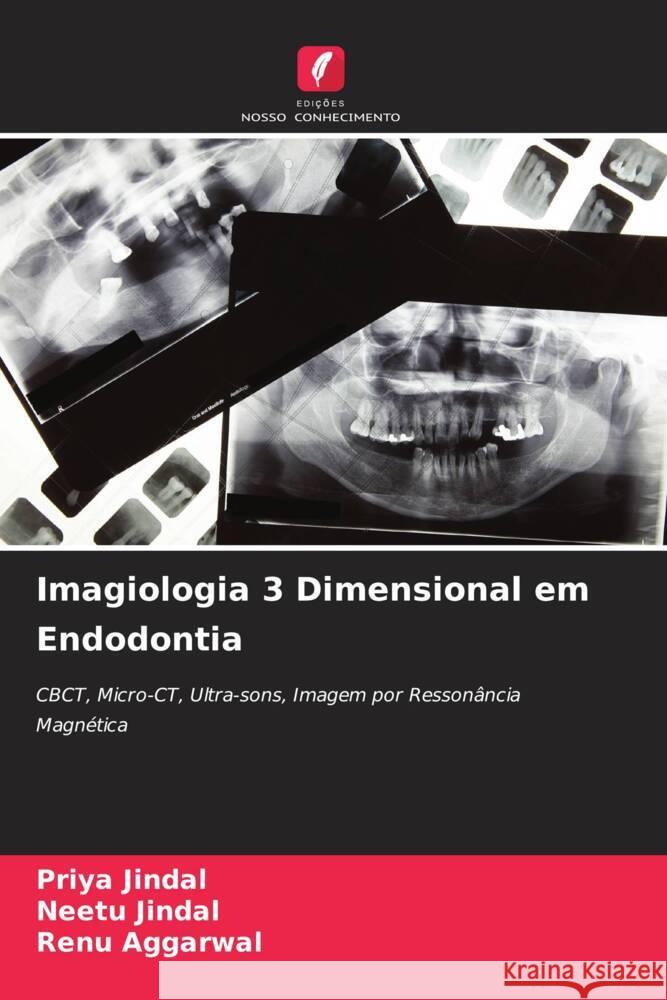 Imagiologia 3 Dimensional em Endodontia Priya Jindal Neetu Jindal Renu Aggarwal 9786207235049