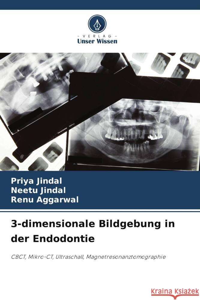 3-dimensionale Bildgebung in der Endodontie Priya Jindal Neetu Jindal Renu Aggarwal 9786207235117