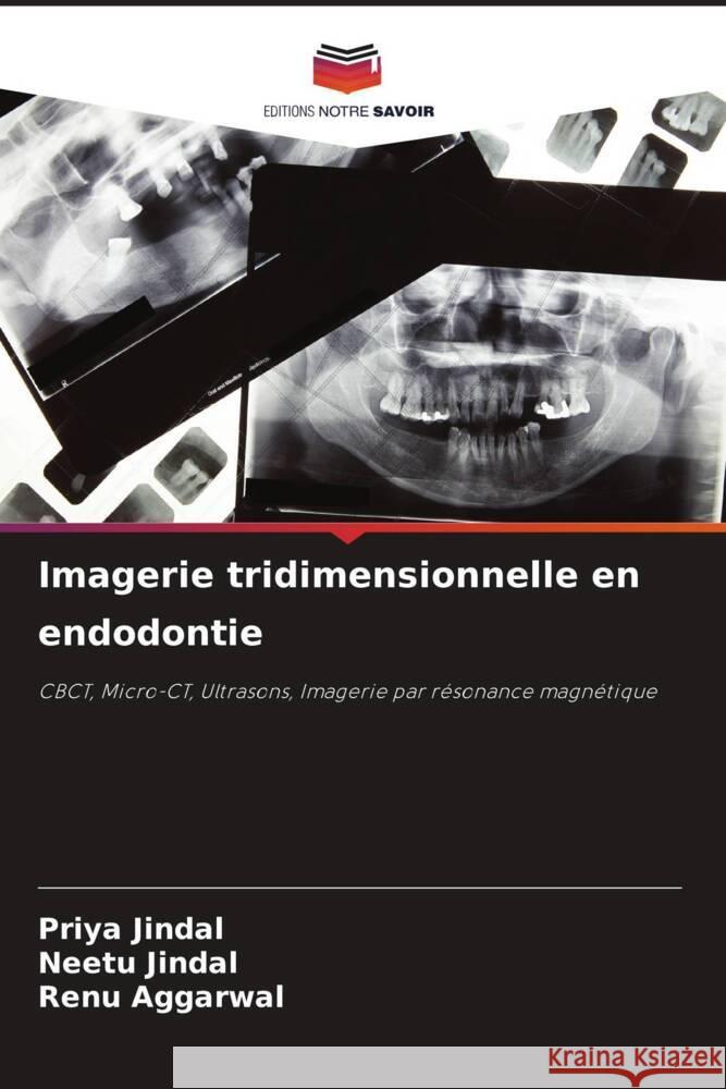 Imagerie tridimensionnelle en endodontie Priya Jindal Neetu Jindal Renu Aggarwal 9786207235131