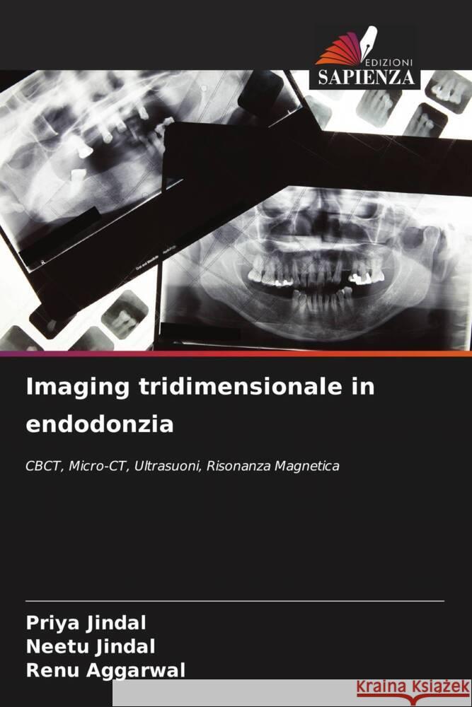 Imaging tridimensionale in endodonzia Priya Jindal Neetu Jindal Renu Aggarwal 9786207235155