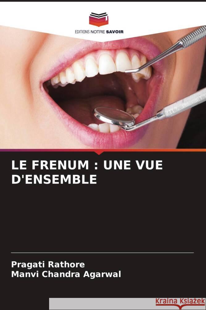 Le Frenum: Une Vue d'Ensemble Pragati Rathore Manvi Chandra Agarwal 9786207241057