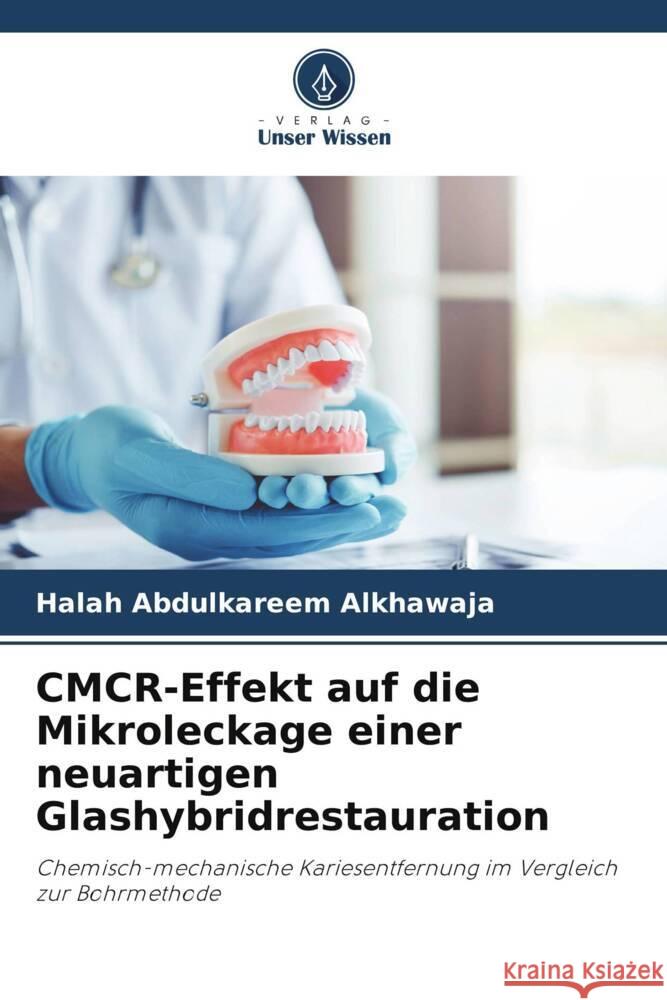 CMCR-Effekt auf die Mikroleckage einer neuartigen Glashybridrestauration Halah Abdulkareem Alkhawaja 9786207241644 Verlag Unser Wissen