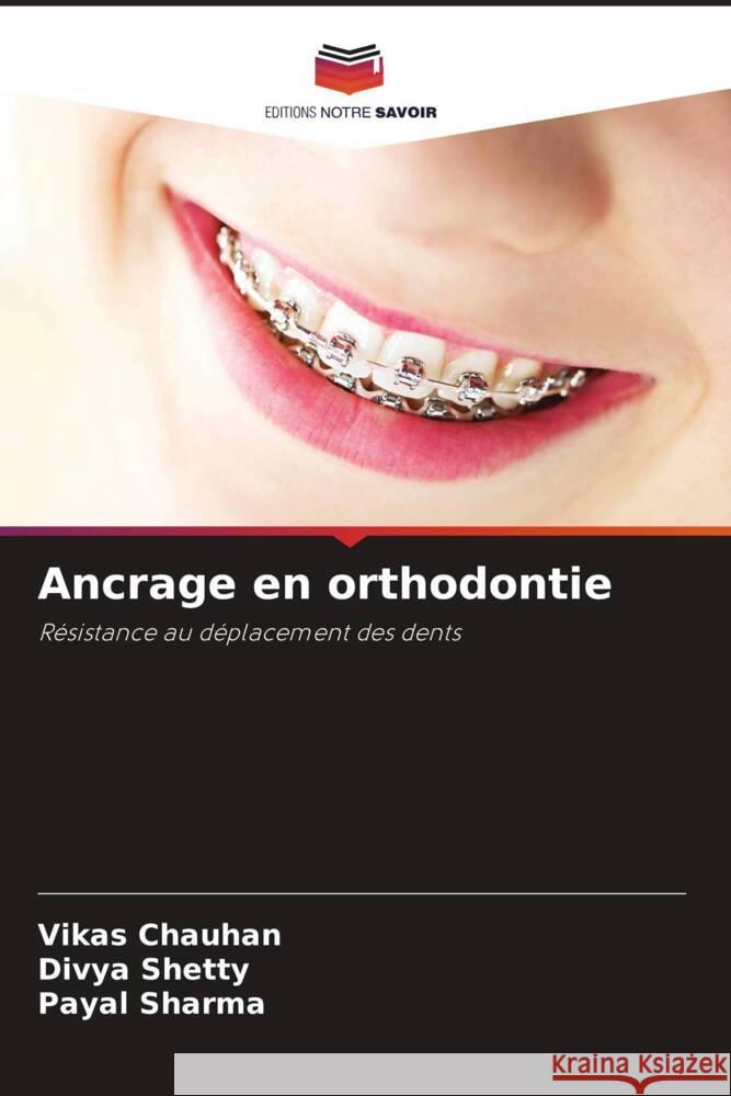 Ancrage en orthodontie Vikas Chauhan Divya Shetty Payal Sharma 9786207242818