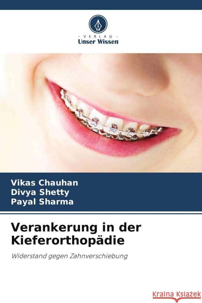 Verankerung in der Kieferorthop?die Vikas Chauhan Divya Shetty Payal Sharma 9786207242832