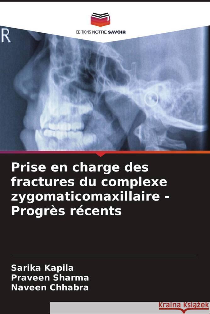 Prise en charge des fractures du complexe zygomaticomaxillaire - Progr?s r?cents Sarika Kapila Praveen Sharma Naveen Chhabra 9786207247363