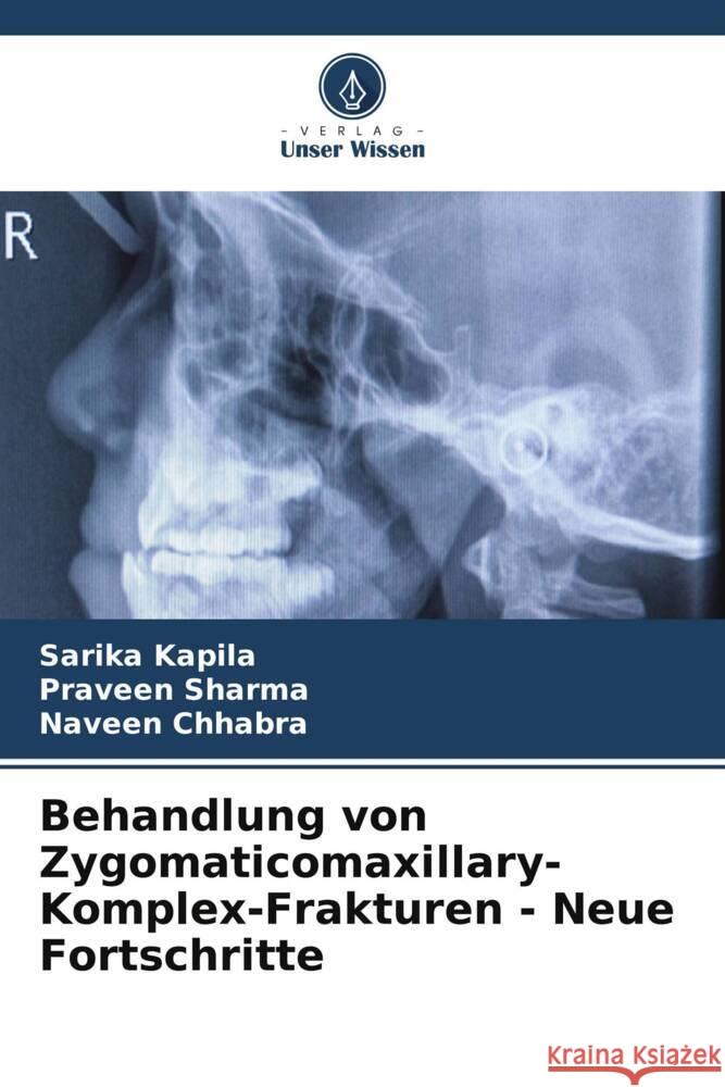 Behandlung von Zygomaticomaxillary-Komplex-Frakturen - Neue Fortschritte Sarika Kapila Praveen Sharma Naveen Chhabra 9786207247387