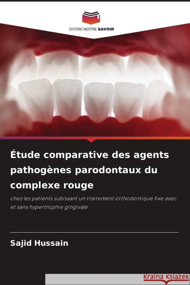 ?tude comparative des agents pathog?nes parodontaux du complexe rouge Sajid Hussain 9786207253111