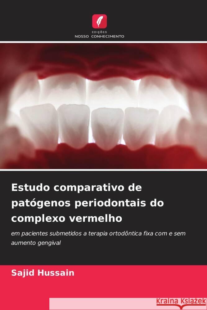 Estudo comparativo de pat?genos periodontais do complexo vermelho Sajid Hussain 9786207253135