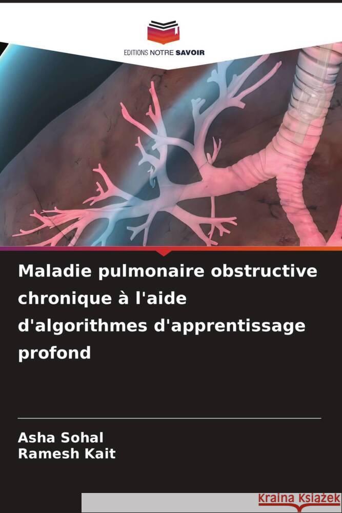 Maladie pulmonaire obstructive chronique ? l'aide d'algorithmes d'apprentissage profond Asha Sohal Ramesh Kait 9786207258765 Editions Notre Savoir