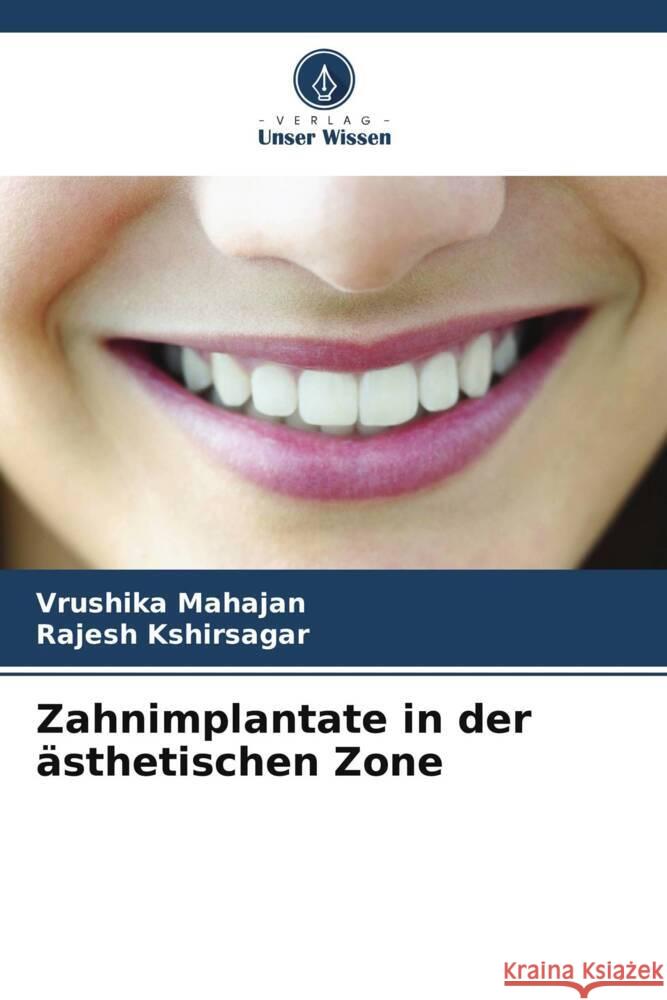 Zahnimplantate in der ?sthetischen Zone Vrushika Mahajan Rajesh Kshirsagar 9786207259731